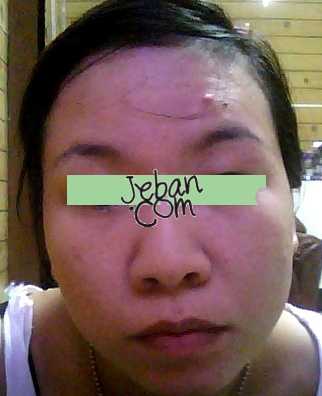 รูปนี้ก่อนทำ ขอโทษนะคะ ที่ไม่ชัดเจน ไม่ได้ตั้งใจถ่ายเพื่อรีวิว