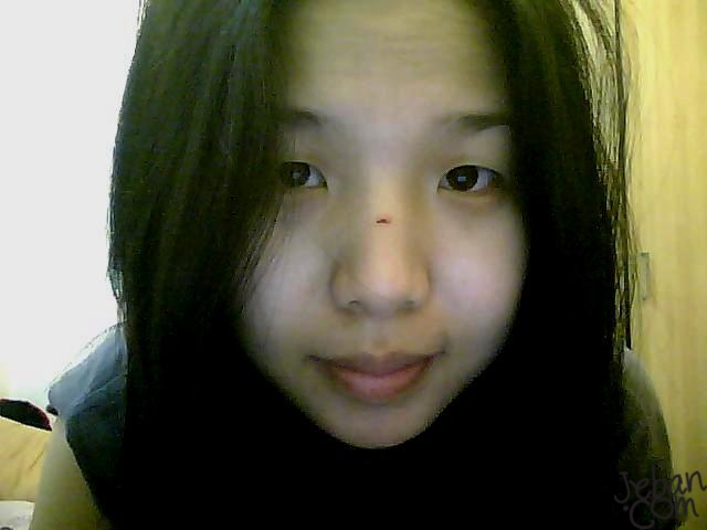 แอบโชว์รอยแตกนิดนึง ตอนนี้ยังบวมอยู่นิดๆค่ะ