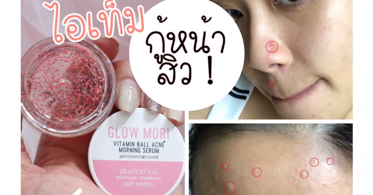 glow mori vitamin ball acne
