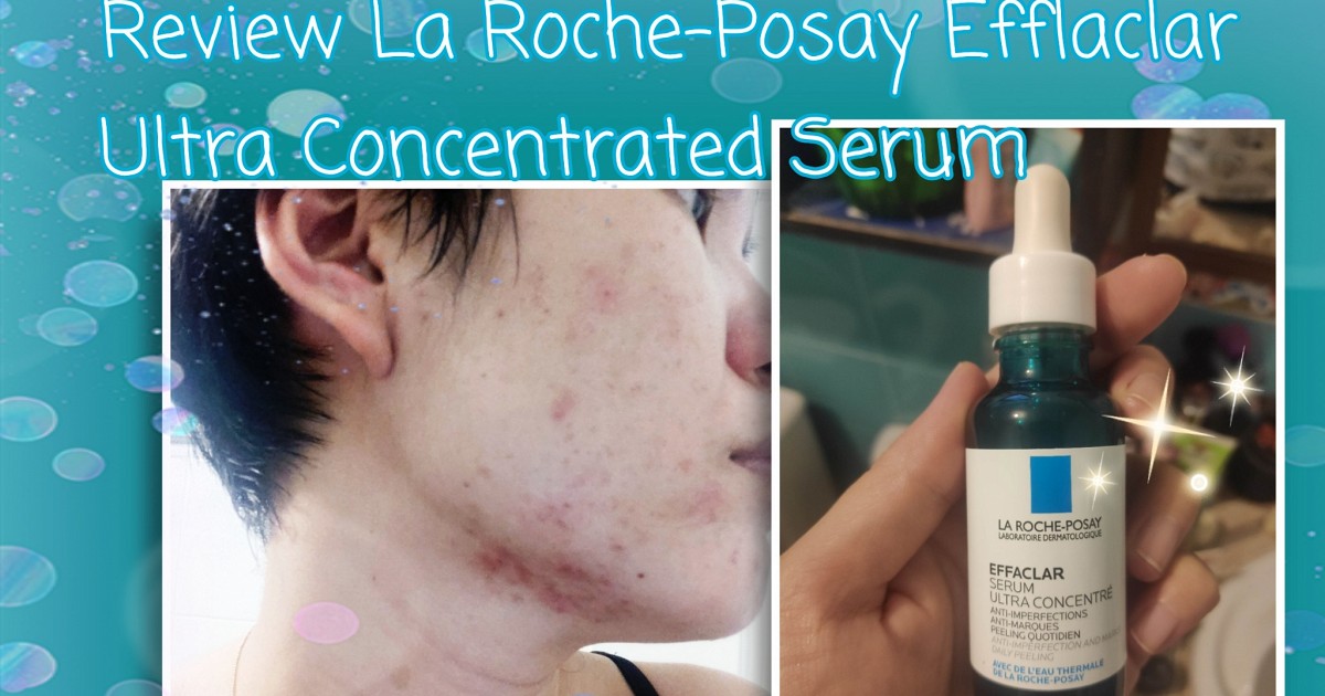 รีวิว La Roche-Posay Efflaclar Ultra Concentrated Serum
