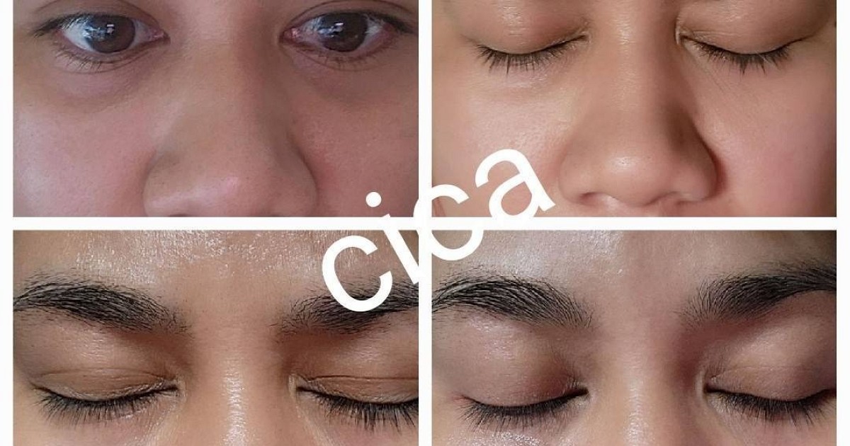 ใต้ตาหมองคล้ำ อยากแนะนำ Plantnery Cica Centella Ceramide Eye Cream