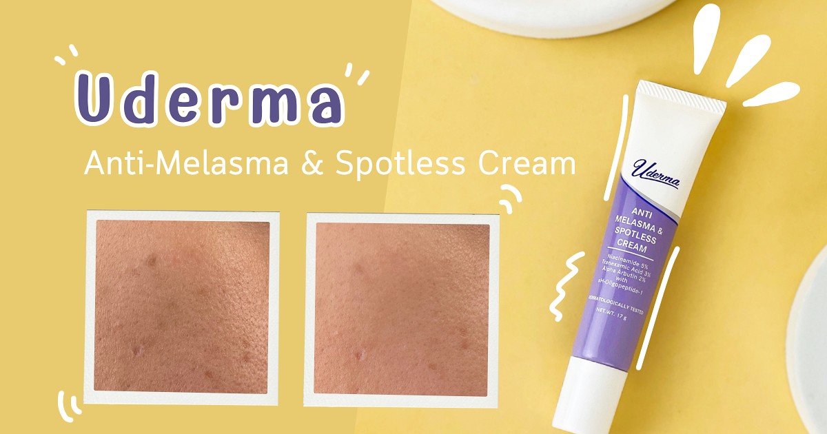 หยุด ฝ้า กระ จุดด่างดำ ด้วย Uderma Anti-Melasma & Spotless Cream