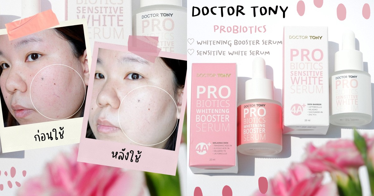 Doctor Rony 2 เปลี่ยนผิวคล้ำให้ดูกระจ่างใสด้วยสกินแคร์ของ DOCTOR TONY