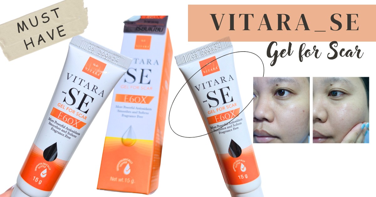 รอยสิวหายช้า ต้องหาตัวช่วย !! VITARA SE GEL FOR SCAR