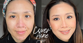 Cover Acne | แต่งหน้าปกปิดรอยสิว