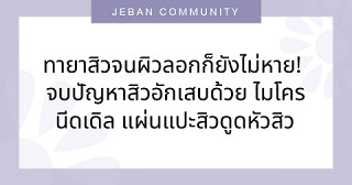 ทายาสิวจนผิวลอกก็ยังไม่หาย! จบปัญหาสิวอักเสบด้วย ไมโครนีดเดิล แผ่นแปะสิวดูดหัวสิวเกลี้ยงแบบไม่ทิ้งรอยแดง