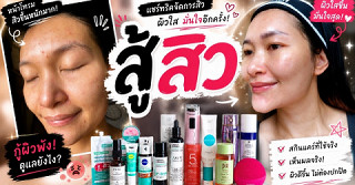 🔥 หน้าพังเพราะสิว! แต่กลับมาผิวใสได้ แชร์ทุกอย่างที่ทำจริง | สู้สิว