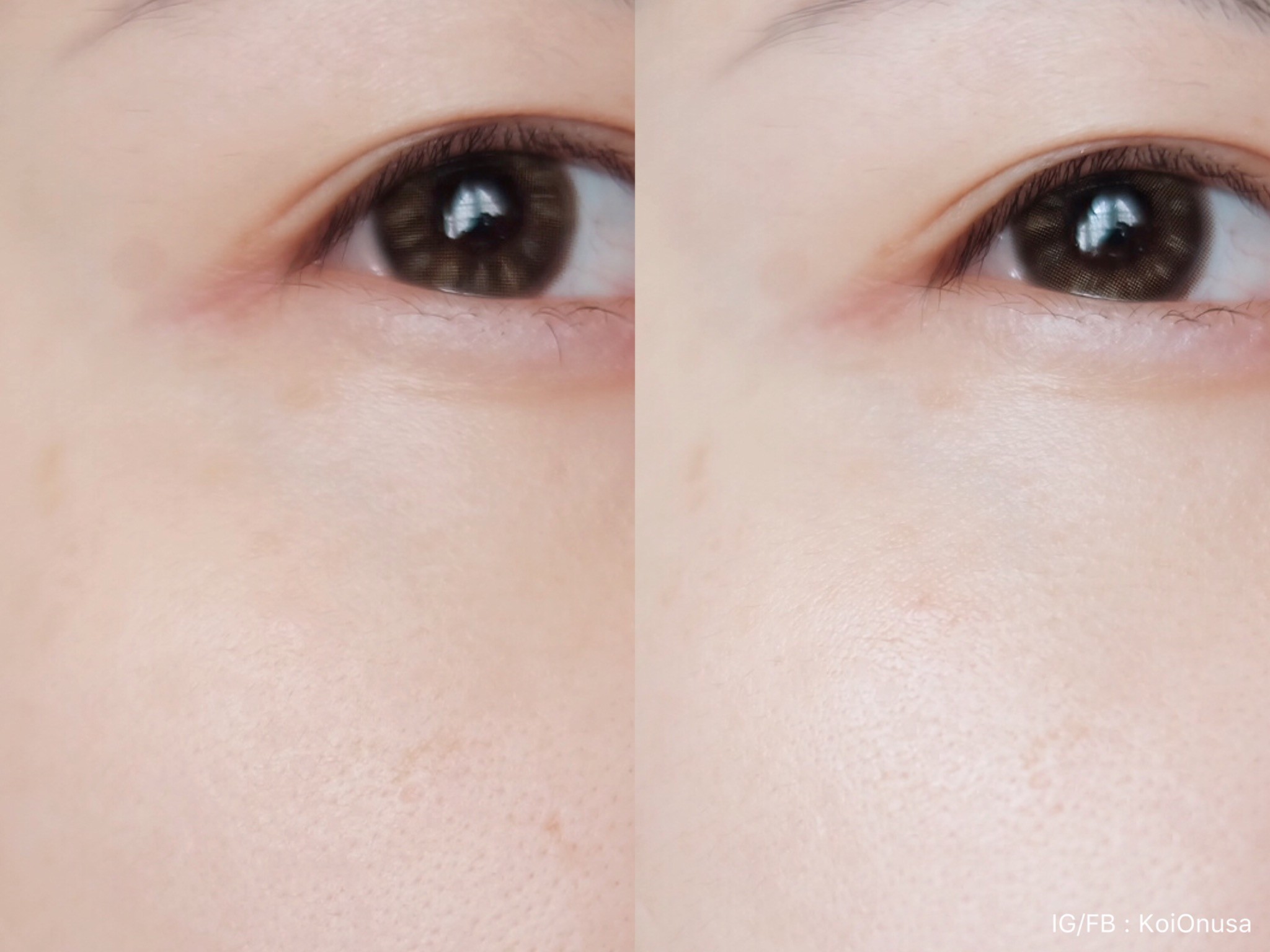 รูปก่อนและหลังใช้