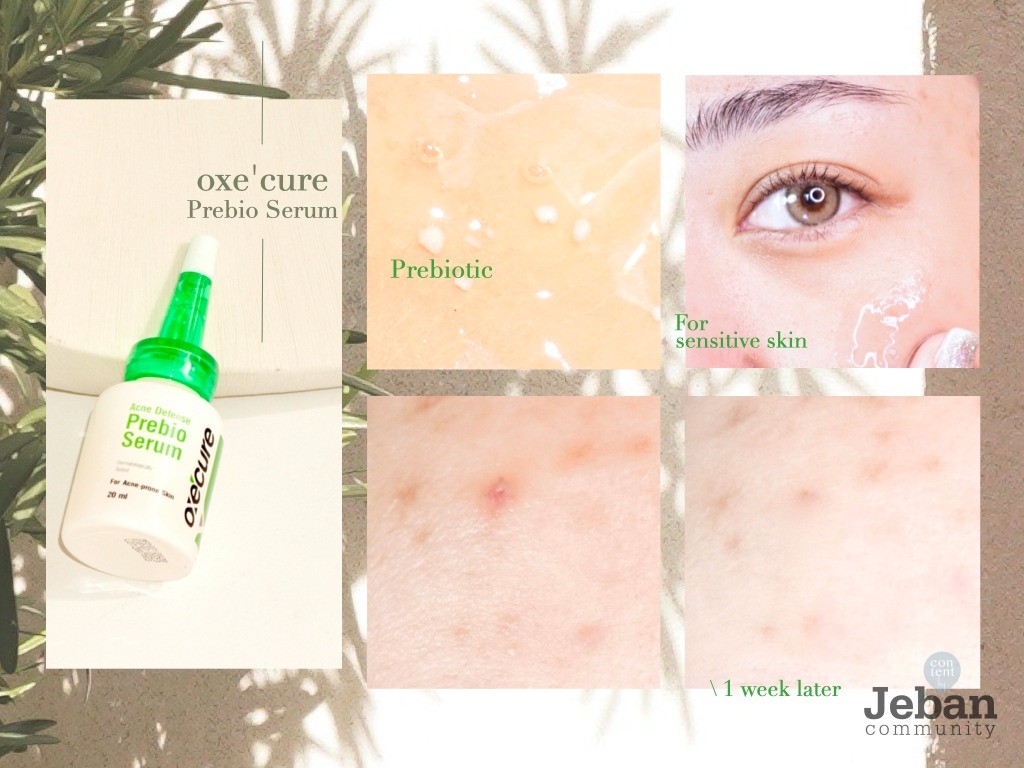 prebio serum oxecure