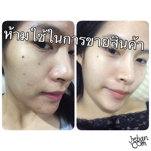 My Image 35