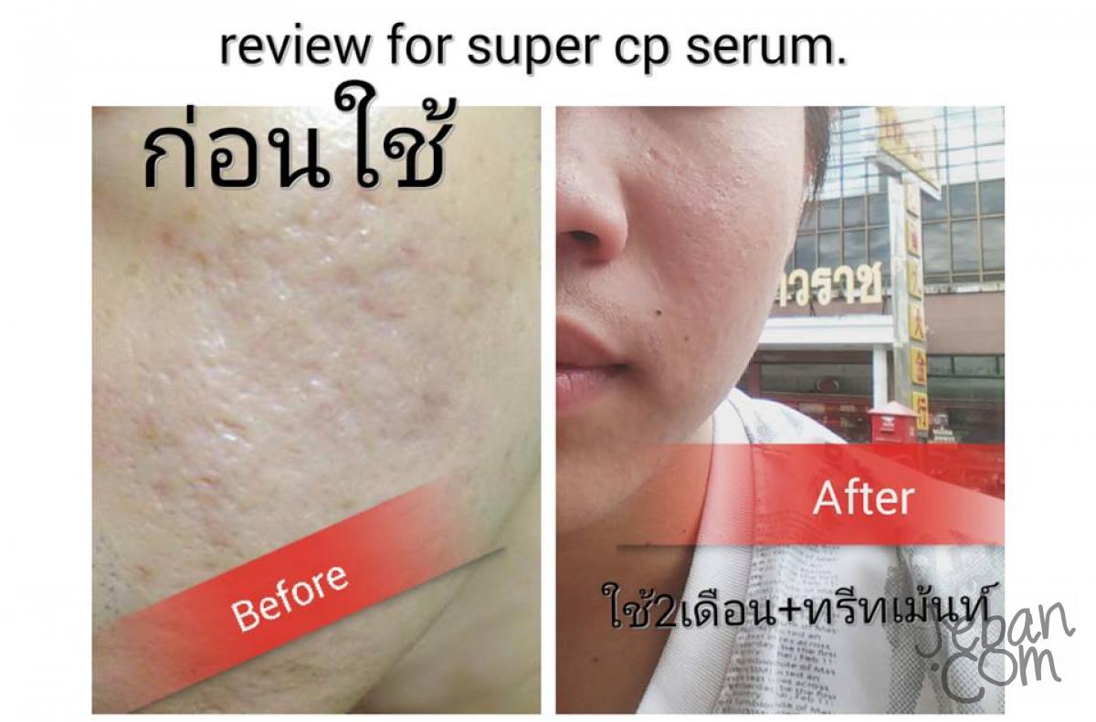 vip serum dr pickart